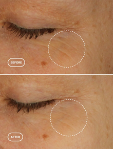 Retinol alternatív szemkörnyékápoló szérum