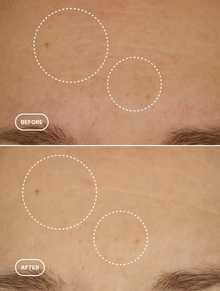 Retinol alternatív arcszérum 30 ml